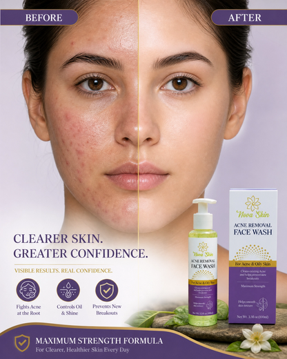 Nova Skin Acne Removal Face Wash for Acne & Oily Skin | Deep Clean Facial Cleanser | Oil Control & Smooth Skin (100ml)